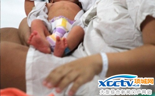 医生30秒紧急剖腹成功救活婴儿